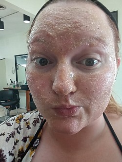 Sugar Scrub (mini Facial)